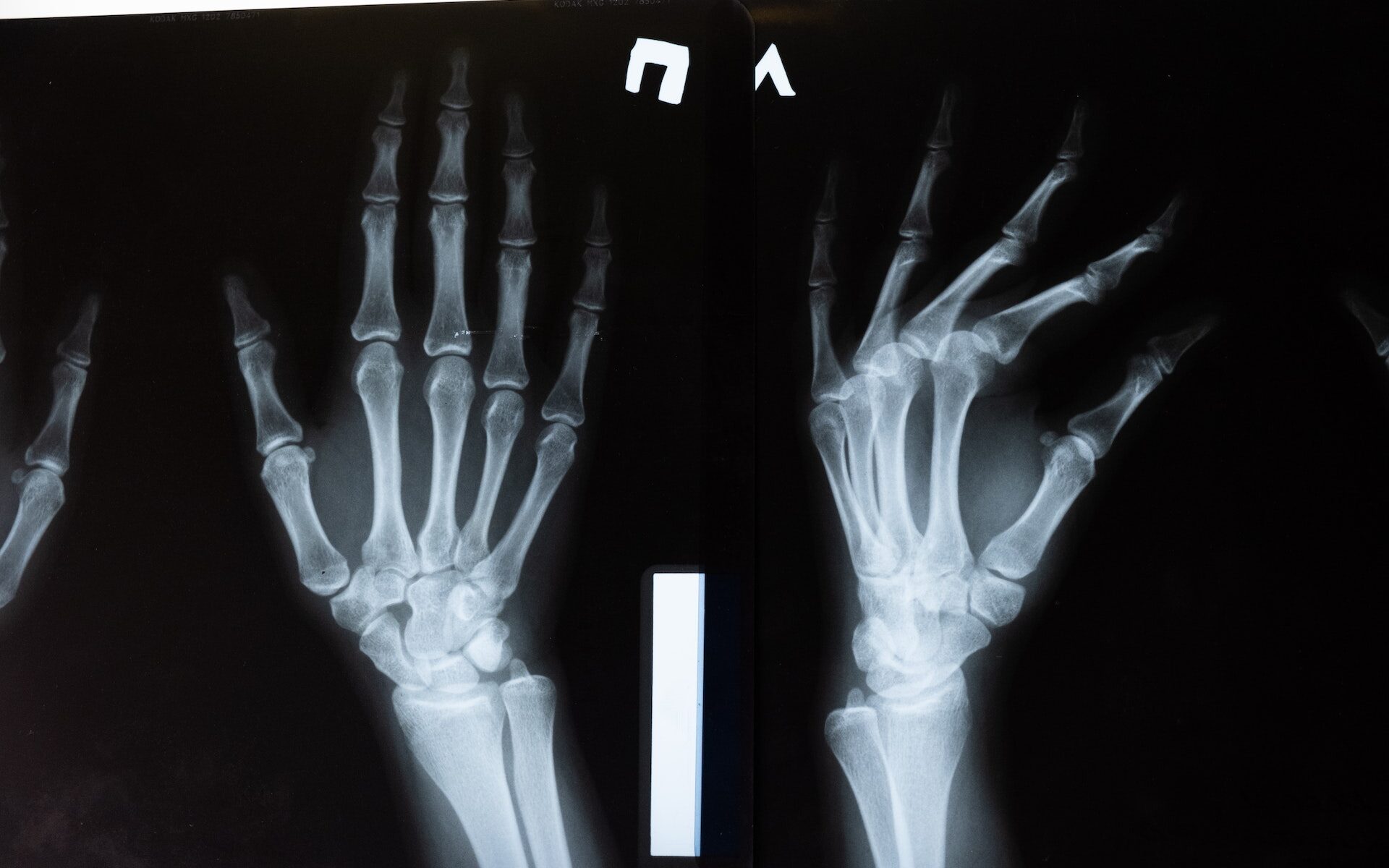Übersetzungsbüro Zürich für Osteologie